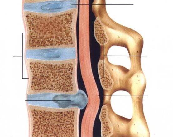 Hernias are pronounced