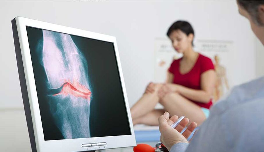 See a doctor if arthritis or osteoarthritis is suspected