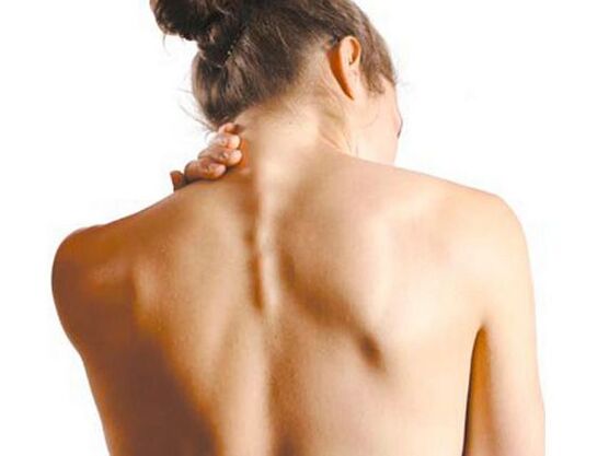 The girl has cervical osteochondrosis.