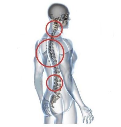 spinal osteochondrosis sites